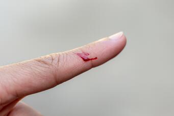 An Introduction to Hemostasis